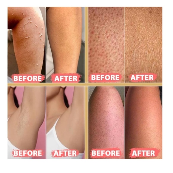 !! Kelebek Premium Natural Exfoliating Glove Exfoliating Mitt Body Scrub - Picture 3 of 4